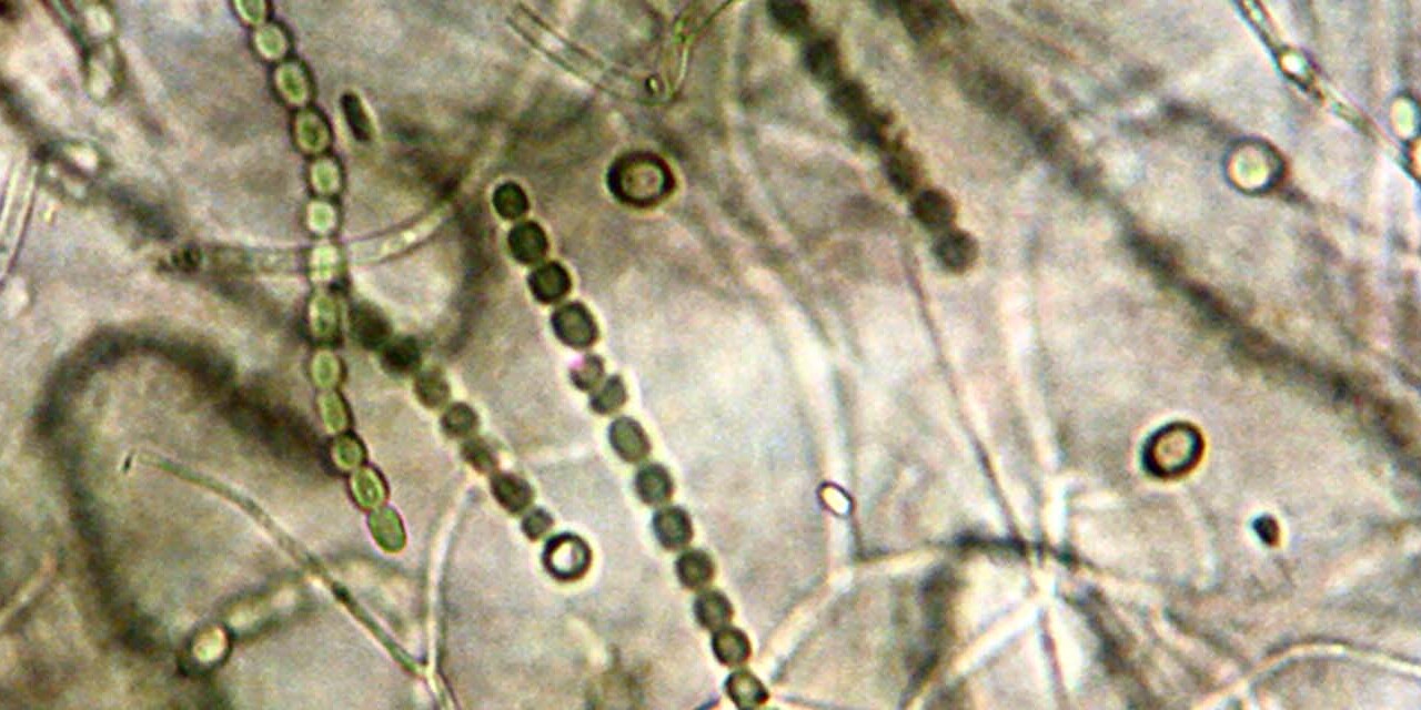 cyanobacteria-toxic-algae-water@2x